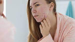 ''Vitamin B12'' : Benefits, Sources, Deficiency"